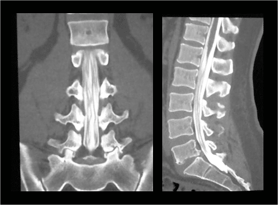 common-spine-tests-what-they-show-rojeh-melikian-m-d