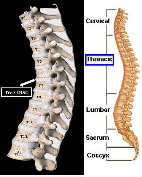 Understanding Spine Anatomy - Rojeh Melikian, M.D.