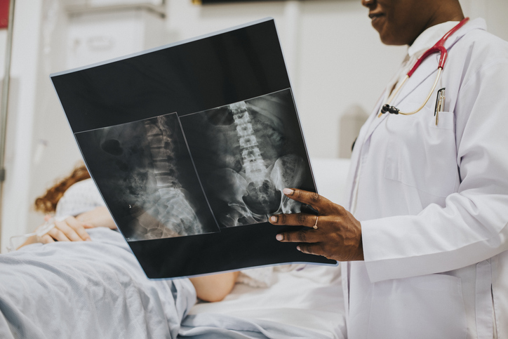 Disc Herniation X-Ray